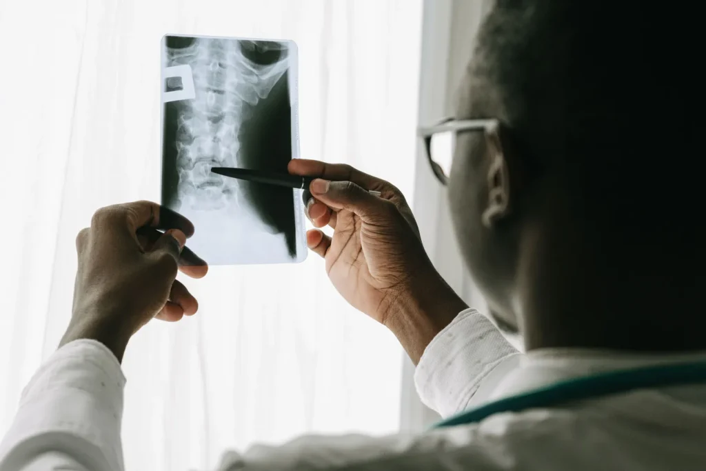 Person in a white coat pointing a pen at a spine X-ray; MRI shows a bulging or herniated disc more clearly